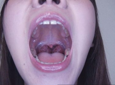 100人のおくち 第8集