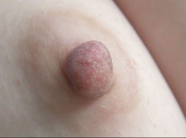 100人の乳首 第12集