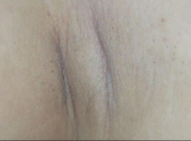 100人のわき 第5集